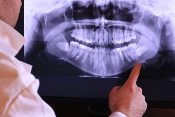 Best Emergency Denture Repair in Dakota City, NE