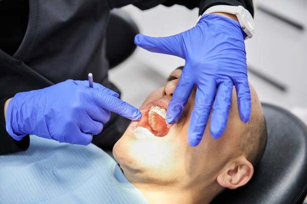 Best Emergency Gum Treatment in Dakota City, NE